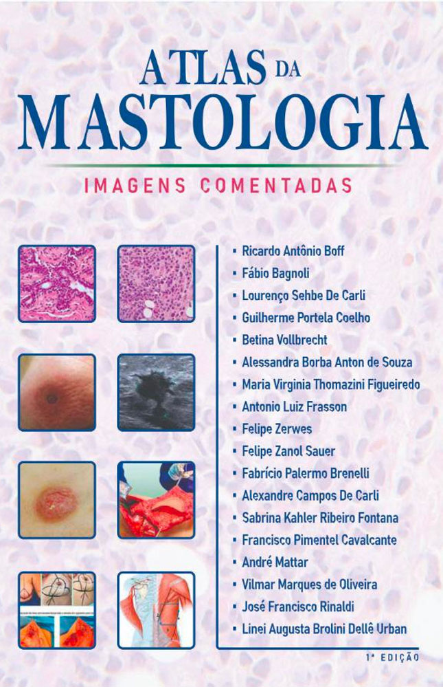 Livro Atlas da Mastologia